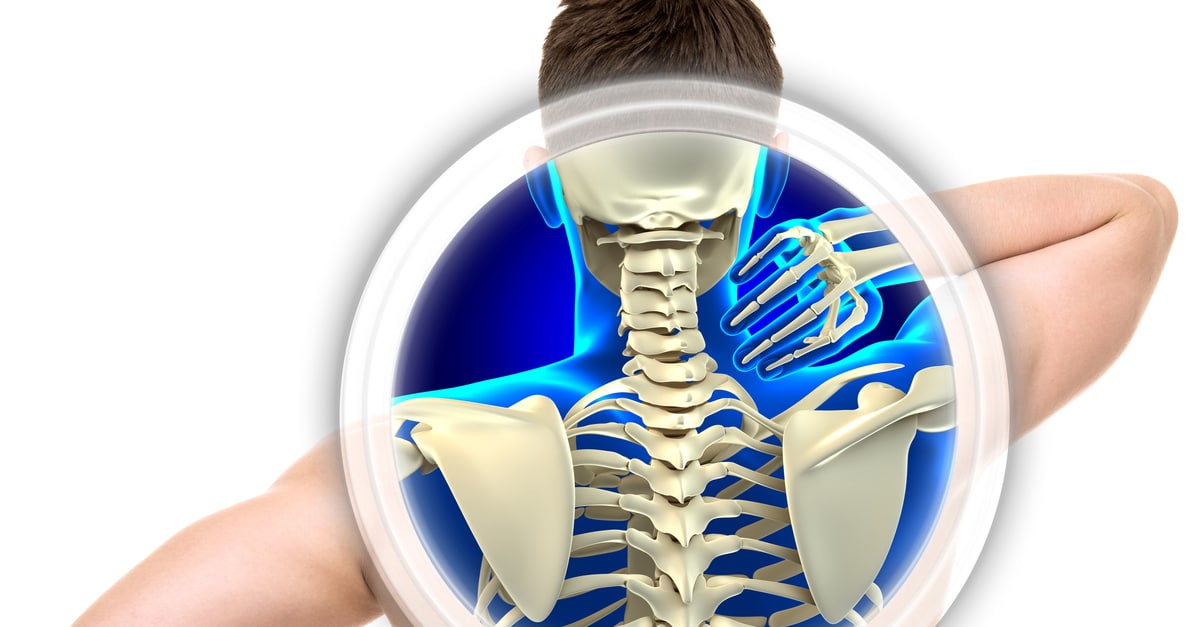 What Is Good For Arthritis Neck Pain